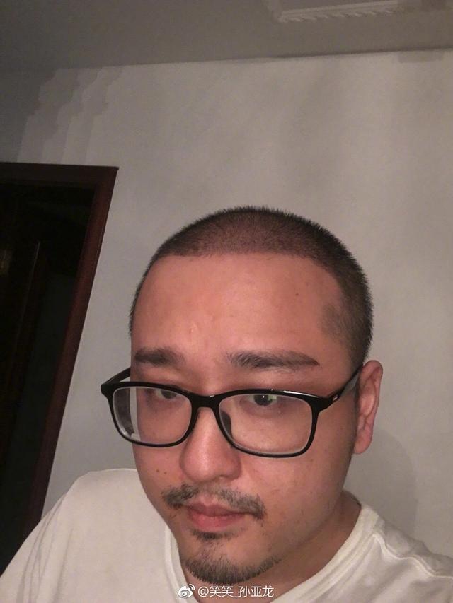 凯发K8官网首页登录LOL笑笑展现植发成果网友一发暴击：西卡